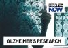 AI Brain Map Shocks Alzheimer’s Research Study brings new insights into Alzheimer's disease