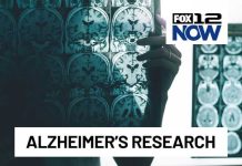 AI Brain Map Shocks Alzheimer’s Research Study brings new insights into Alzheimer's disease