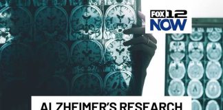 Study brings new insights into Alzheimer's disease