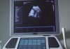 After birthright citizenship ruling, Texas Republicans scrutinize surrogacy and birth tourism
