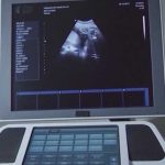 Birth Tourism Panic Meets 14th Amendment Wall After birthright citizenship ruling, Texas Republicans scrutinize surrogacy and birth tourism