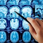 Hand pointing at brain scan images on screen