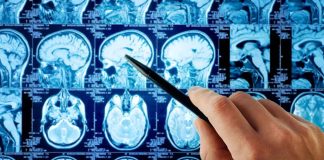 Hand pointing at brain scan images on screen